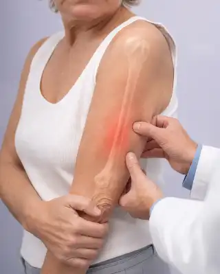 Elderly Patient with Upper Arm Pain and Bone Inflammation - Orthopedic Stock Photo