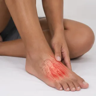 Foot Fracture Pain and Bone Injury - Orthopedic Medical Stock Photo