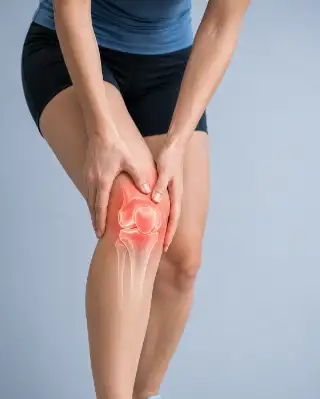 Runner Experiencing Acute Knee Pain and Joint Inflammation - Medical Stock Photo