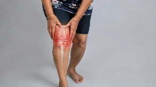 Elderly Patient Suffering From Knee Osteoarthritis and Joint Pain - Orthopedic Stock Photo