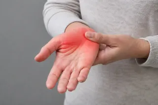 Person Experiencing Carpal Tunnel Pain and Inflammation in Palm