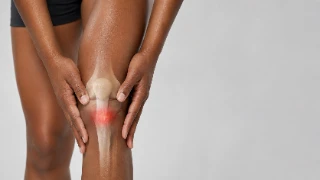 Patellar Tendinitis Knee Pain Illustration - Orthopedic Medical Stock Photo