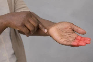 Patient Assessing Hand Tingling and Numbness Symptoms - Clinical Stock Photo