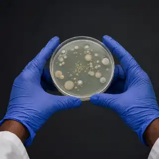 Scientist Examining Bacterial Colonies Growing in a Petri Dish - Laboratory Stock Photo