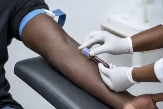 Arm Venipuncture Procedure Drawing Blood Sample in Clinical Laboratory