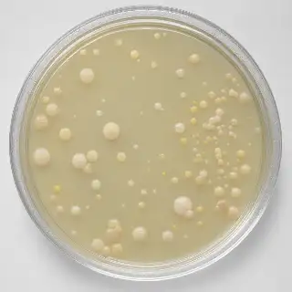 Bacterial Colony Growth on Agar Plate in Microbiology Laboratory