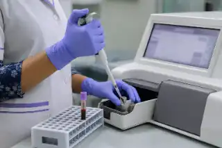Medical Laboratory Technician Performing Hemoglobin Analysis with Blood Sample and Analyzer