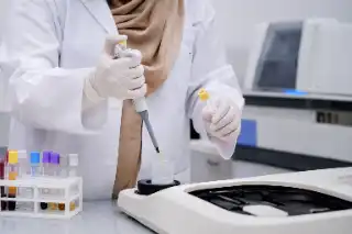Laboratory Technician Performing Cholesterol Blood Testing With Pipette - Medical Stock Photo