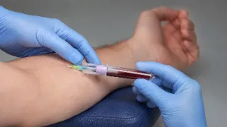 Medical Professional Performing Phlebotomy Tube Insertion For Blood Test