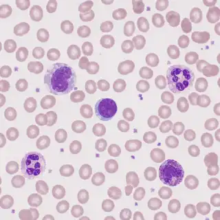 Normal Blood Cell Morphology Showing White Blood Cells and Red Blood Cells