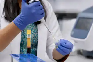 Medical Laboratory Technician Performing Serum Analysis with Pipette and Test Tube