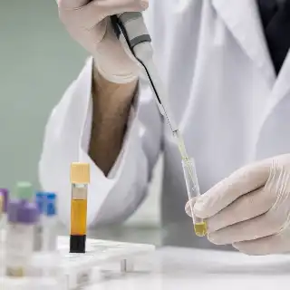 Laboratory Technician Analyzing Plasma Sample With Pipette - Medical Stock Photo