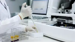 Laboratory Technician Performing Glucose Testing with Pipette in Clinical Lab